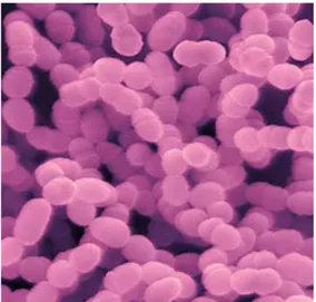 Gambar 2: Gambaran mikroskopis Streptococcus  