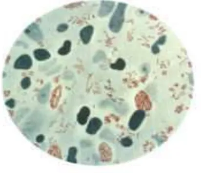 Gambar 2.1.  bakteri Mycobacterium leprae 
