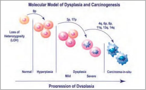 Gambar 3. Model Molekul Displasia Dan Karsinogenesis 
