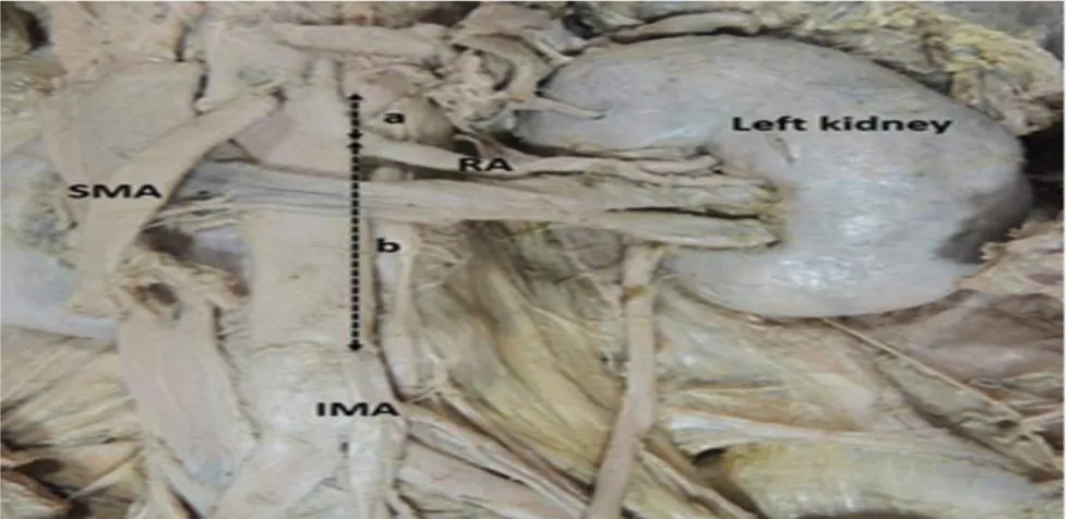Gambar 1. Posisi Letak Arteri Renalis pada Ginjal Kiri. 1