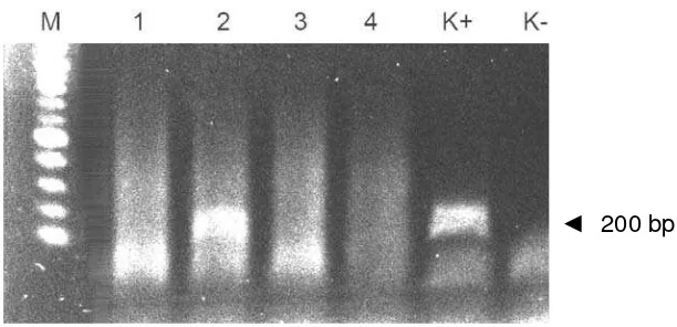 Gambar  8.    Deteksi ekspresi dari transgen pada ikan founder menggunakan metode RT-PCR menggunakan cetakan cDNA