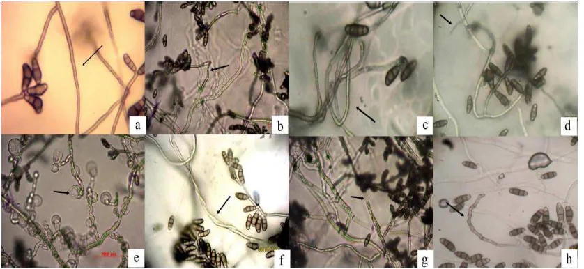 Gambar 4.3.1 Hifa Curvularia sp. (a) Normal, (b) Lisis dan patahEnterobacter sp. BK15, (c) MembengkokBacillus sp
