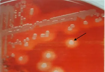 Gambar 2. Koloni Staphylococcus aureus pada cawan agar darah sesudah inkubasi 24  jam