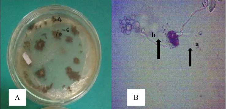 Gambar 8.Rhizopus sp., (A) koloni berumur 14 hari pada media PDA dan (B) bentuk mikroskopis konidia (a) dan konidiofor (b) dengan perbesaran 100 kali  