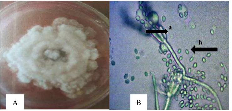 Gambar 5.Fusarium sp., (A) koloni berumur 14 hari pada media PDA dan (B) bentuk mikroskopis konidia (a) dan konidiofor (b) dengan perbesaran 100 kali
