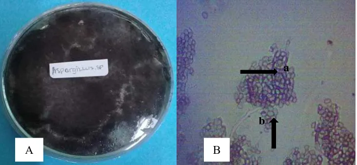 Gambar 6.Aspergillus  sp., (A) koloni berumur 14 hari pada media PDA dan (B) bentuk mikroskopis konidia (a) dan konidiofor (b) dengan perbesaran 100 kali  