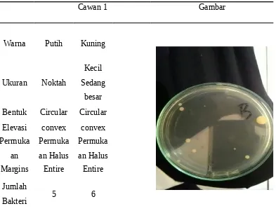 Tabel 1Hasil screening bakteri di toilet pada cawan 1 (Tangga CB)