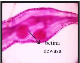 Gambar 6  Meloidogyne spp. betina di dalam puru akar tomat. 