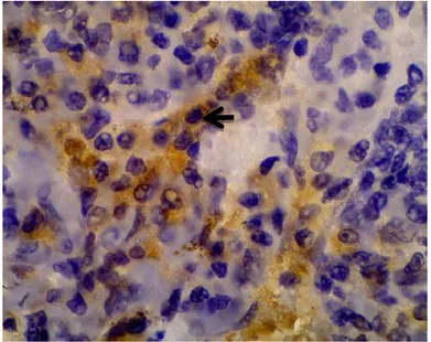 Gambar 1. Ekspresi Caspase 3 Sel Limfosit pada Limpa Tikus yang Diinfeksi Escherichia coli ESBL  dengan Perbesaran 1000x (sitoplasma sel berwarna cokleat seperti yang ditunjukkan dengan tanda 