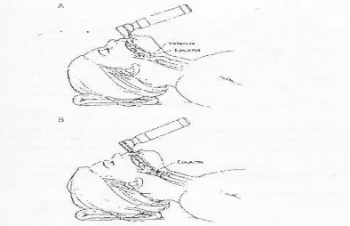 Gambar 2. Laringoskop berdaun lurus dan lengkung 
