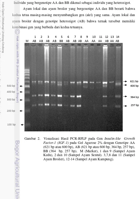 Gambar 2.  Visualisasi Hasil PCR-RFLP pada Gen Insulin-like  Growth 