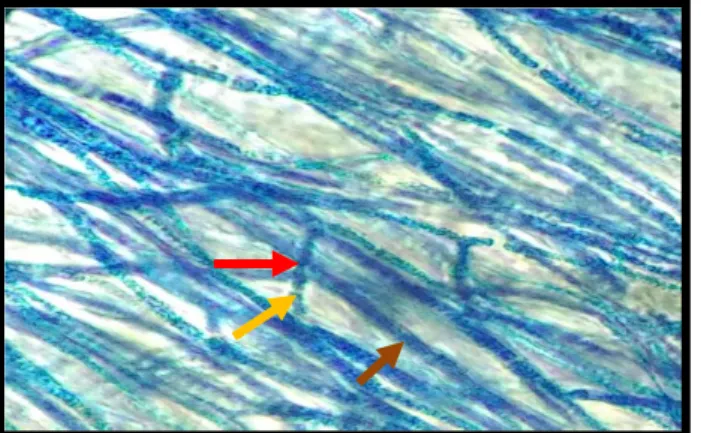 Gambar 2. Mekanisme Penghambatan antara Kapang Antagonis Trichoderma harzianum  terhadap Kapang Patogen Curvularia mosaddeghii secara Mikroskopis