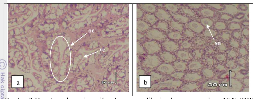 Gambar 3 Hepatopankreas juvenile udang yang diberi pakan mengandung 10 % TBK 