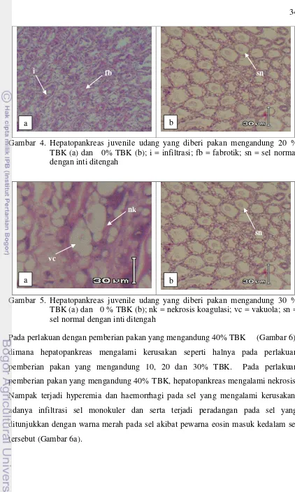 Gambar 4. Hepatopankreas juvenile udang yang diberi pakan mengandung 20 % 