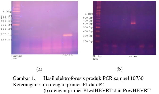 Gambar 1.      Hasil elektroforesis produk PCR sampel 10730 