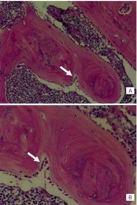 Figure 2. Radiological evaluation at 8(left) showed complete bone formation with remodelling of in-tramedullary canal (score 8) while in autoclave group (right), the th week