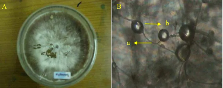 Gambar 7.                konidiofor (a), konidia (b)  Absidia sp koloni berumur 14 harinpada media PDA (A) dan bentuk mikroskopik (B)                                         