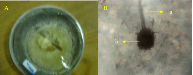 Gambar 8. Aspergillus sp koloni berumur 14 hari pada media PDA (A) dan bentuk                             Mikroskopik (B), konidiofor (a), konidia (b) 