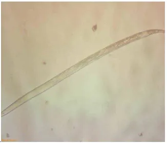 Gambar 1. Nematoda Meloidogyne spp (Sumber : Foto langsung) 