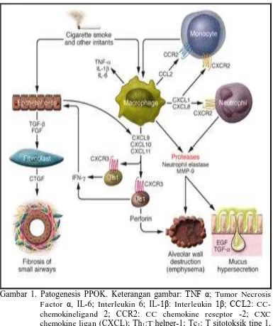 Gambar 1. Patogenesis PPOK. Keterangan gambar: TNF α; Tumor Necrosis Factor α, IL-6; Interleukin 6; IL-1β: Interleukin 1β; CCL2: CC-chemokineligand 2; CCR2: CC chemokine reseptor -2; CXC chemokine ligan (CXCL); Th1:T helper-1; Tc1: T sitotoksik tipe 1, MMP