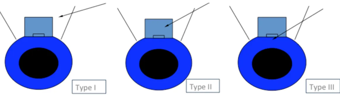 Gambar 4. Lokasi jarum (tanda panah) pada needling tipe 1,2, dan 3 