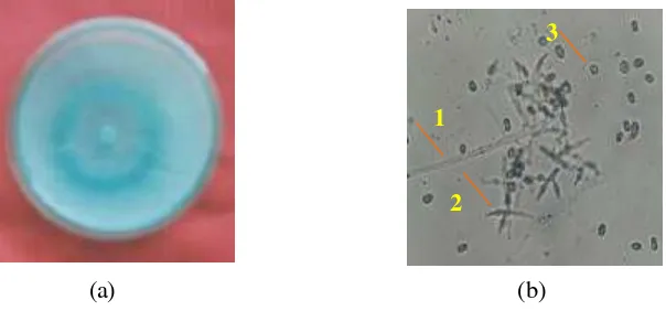 Gambar 4  Trichoderma sp.: (a) koloni pada media PDA berumur 5 hari, (b1) hifa, (b2) fialid dan (b3) konidia    