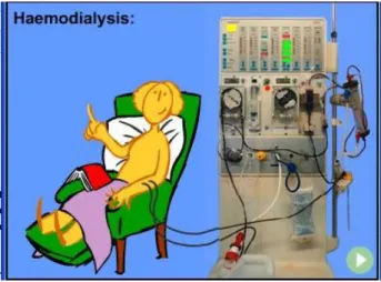 Gambar 2.8 Mesin hemodialisis 