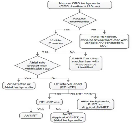 Gambar 3. Alogaritme diagnosis banding untuk suatu takikardia kompleks sempit pada  pasien dewasa