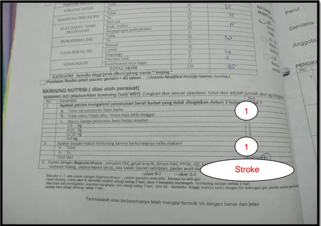 Gambar 2.1 Skrining Gizi meggunakan Malnutrition Skrining Tools (MST) 