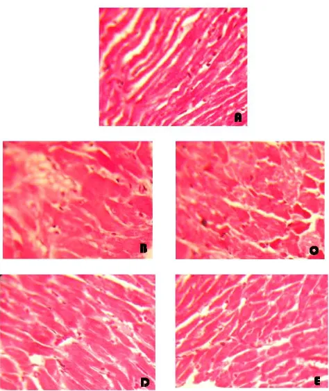 Figure  1. Microphotograph of cardiac muscle tissue to show the ibrotic area. Photographed using olympus CH20 microscope camera    magniication 10x40