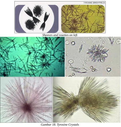 Gambar 18. Tyrosine Crystals