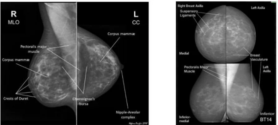 Gambar  2.3.  (a)  Mammografi  normal  MLO  dan  CC  view  (b)  Mammografi  normal  MLO dan CC view pada fatty breast