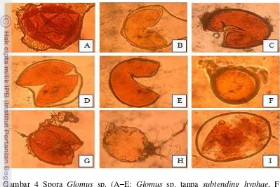 Gambar 4 Spora Glomus sp. (A–E: Glomus sp. tanpa subtending hyphae, F: 