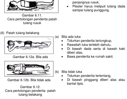 Gambar 6.11.