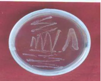 Gambar 9.  Koloni Bakteri Simbion (Xenorhabdus sp.) 