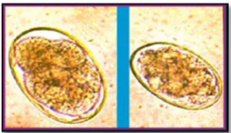 Gambar 6. Telur Bunostomum sp. (Sumber : Purwanta, 2009) 