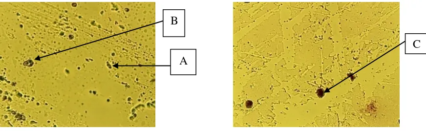 Gambar 2. Diagram Batang Kapasitas Sel Makrofag pada Cairan Peritonium Mencit Jantan Putih Terhadap Dosis Ml/20 G BB