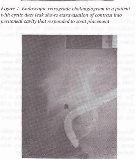Table 2. Therapeutic ERCP interventions in 11 patients