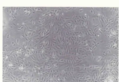 Figure 1. The tnorphology of hwnan endothelial cells at conJluence stage (100 x)