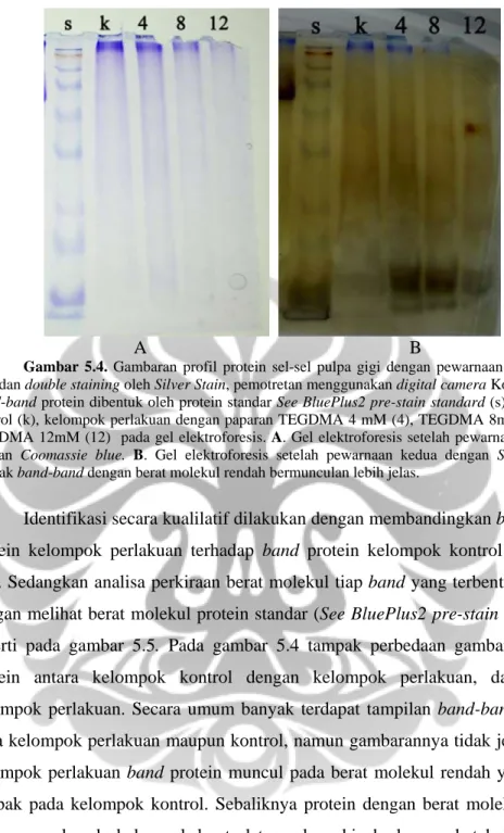 Gambar 5.4. Gambaran profil protein sel-sel pulpa gigi dengan pewarnaan Coomassie  blue dan double staining oleh Silver Stain, pemotretan menggunakan digital camera Kodak M853