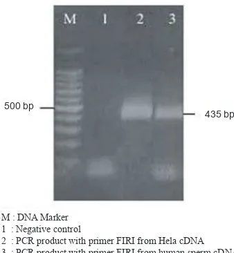 Figure 2.   Agarose gel electrophoresis of ampliied human sperm VDAC3 cDNA. The amplicon in size of 435 bp is the target fragment for cloning to pET 101/D-TOPO vector