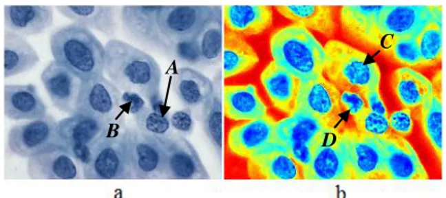 Fig. 1.   (a) Bagian dari citra Papsmear, (b) Peta warna dari Gambar 1.(a).   Untuk  membedakan  sel  epitel  dan  sel  radang  dapat  dilakukan  dengan  menggunakan  algoritma  klasifikasi