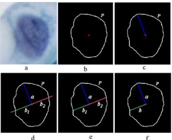 Fig. 2.   (a)  Sel  radang,  (b)  Sel  Epitel,  (c)  Segmentasi  sel  radang,  (d)  Segmentasi sel epitel, (e) Segmentasi sel  radang dengan penanda  Major  dan 