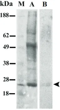 Gambar 3.  Penghambatan proliferasi limfosit mencit Balb/c oleh ekstrak testis sapi bali (ET) dapat dianulir oleh anti TGF-β1 antibody (ET+a- TGF-β1) baik saat dikultur dengan Con A (A) maupun IL-2 (B)