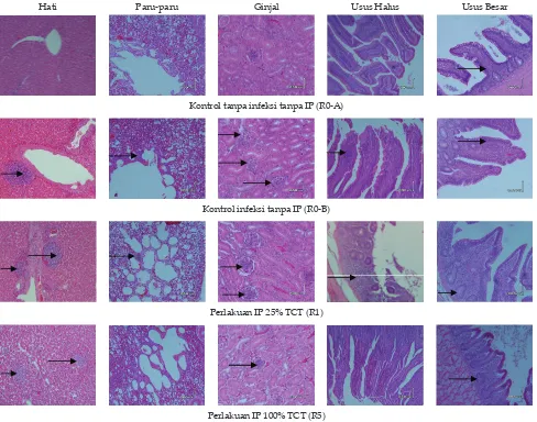 Gambar 1.  Histopatologi pada organ hati, paru-paru, ginjal, dan usus ayam broiler yang diinfeksi Salmonella pullorum setelah pemberian imbuhan pakan (IP) yang mengandung tepung cacing tanah (TCT)