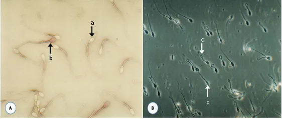 Figure 1. Assesment of spermatozoa (A); live spermatozoa with white spermatozoa head (a), dead spermatozoa with red spermatozoa ����������������������������������������������������� ��� ������������ ����������� ���and not coiled (d) (phase contrast microscope, 200x magnification).����������������������������������������������� �������������������������� ���������������� ����������� �������� ����������� ������������������������������������ ���������� �� ����������� ����� ���� ����������� ����� ����� �����������head (b) (phase contrast microscope, 400x magnification), and (B) membrane integrity with HOS test; coiled spermatozoa (c) �