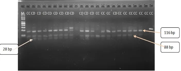 Figure 1. Visualization of GH Gene Amplification on 1.5% agarose gel. Lane M=1000 bp DNA Marker, Lanes 1-25= PE goat samples