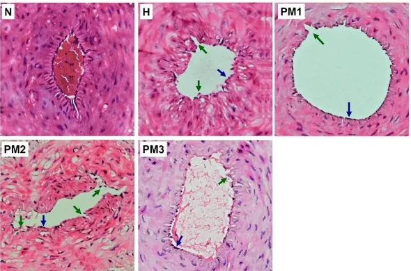 Figure 3. Histopathological Examination of Hematoxylin-eosin-stained Rat Tail Artery Sections