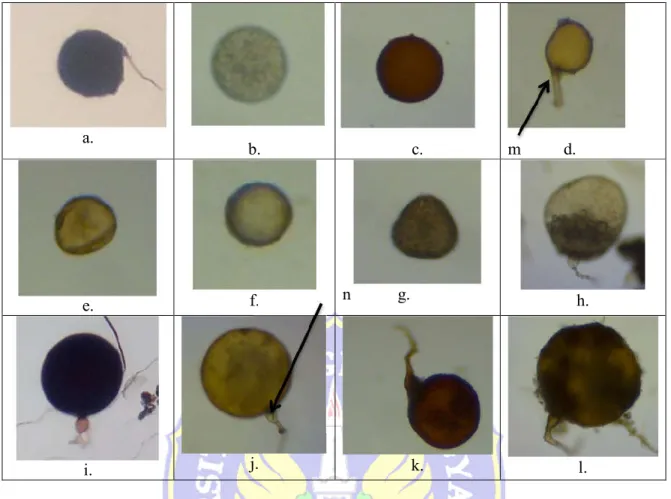 Gambar  1.  Hasil  isolasi  dan  identifikasi  Mikoriza  Vesikular  Arbuskular  (MVA)  yang  diperoleh  pada  rizosfer  gulma  siam  di  tiga  lahan  berbeda  (lahan  pantai  berpasir,  lahan  karst,  dan  lahan  vulkanis)