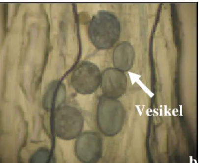 Gambar 13. Hifa (a) dan vesikel (b)   pada akar semai jati  Muna pada umur 12 MST  (pengamatan menggunakan m ikroskop binokuler Nikon YS100  dengan  perbesaran  100x) 